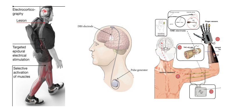 Image description below